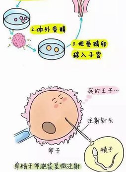 深圳市人民医院试管费用多少(深圳武警试管还是北大哪里做试管婴儿手术好)