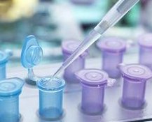 重庆做试管婴儿的价格揭秘，让你不花冤枉钱