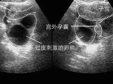 私立医院可以做三代试管吗？